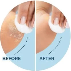 Scholl Velvet Smooth Voetvijl Wet & Dry - Starter - 1 Stuk -Cosmetic Verkoop 1196x1200 2