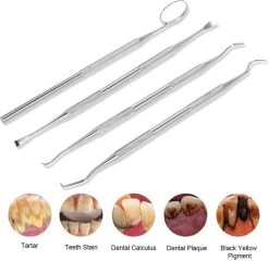 Compleet Tandarts Setje –4 Stuks Tandsteenhaakje – Tandartshaakje - Mondspiegel – Tandarts Gereedschap – Mondverzorging – Stainless Steel -Cosmetic Verkoop 1200x1166 5