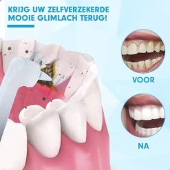 DEN-T® PRO P350 Elektrische Tandenpolijster - Wit - 5 Standen - 5 Opzetstukken - Polijstmachine - Polijstset - Tanden Polijsten - -Cosmetic Verkoop 1200x1200 371