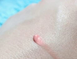 Biodermal Sun Lipbalm SPF25 - Tube 12 Ml - Natural Pink - Lippenbalsem -Cosmetic Verkoop 1200x927